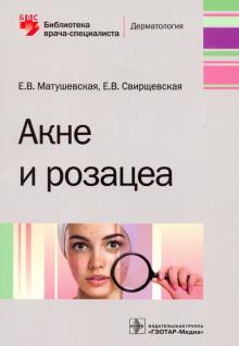 Свирщевская, Матушевская - Акне и розацеа обложка книги Свирщевская, Матушевская - Акне и розацеа обложка книги