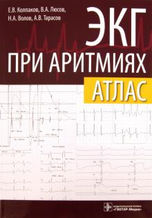 Колпаков, Люсов, Волов, Тарасов - ЭКГ при аритмиях. Атлас + линейка электрокардиографическая обложка книги Колпаков, Люсов, Волов, Тарасов - ЭКГ при аритмиях. Атлас + линейка электрокардиографическая обложка книги